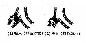 不完全阻塞型(引起肺气肿)