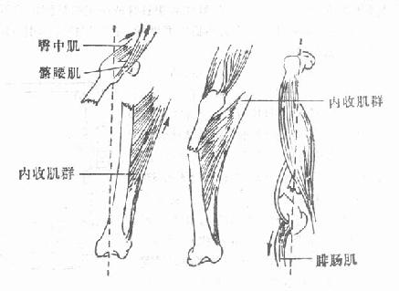 股骨干上、中、下1/3骨折移位情况及其发生原因