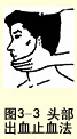  ͷѪֹѪ